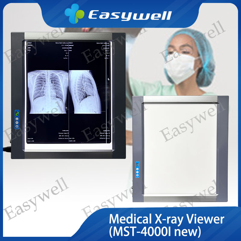 Medical X-ray Illuminator/Negatoscope