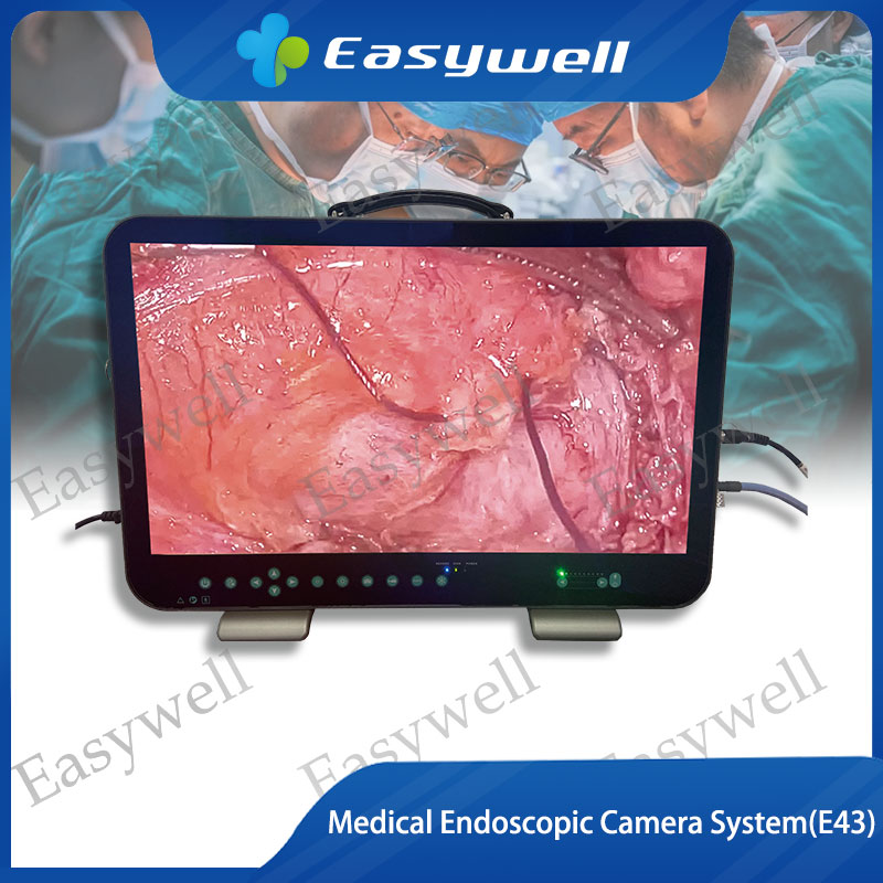 Medical Endosopic Camera Systems